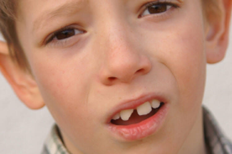 ACC accident dental consultation